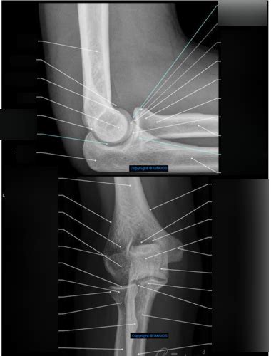 ramble elbow trite *** olate quizlet|Anatomy.